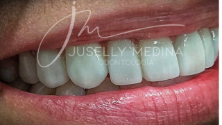 dentistas ortodoncistas en guayaquil Dra. Juselly Medina. Odontología, Rehabilitación Oral, Estética Dental, Ortodoncia